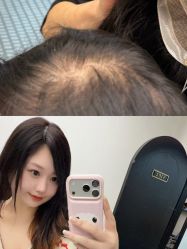 -唐风采假发补发定制