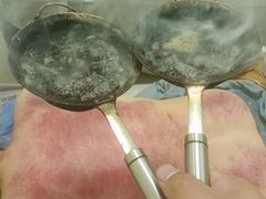 -张钰强中医正骨推拿连锁(唐家人才公寓店)