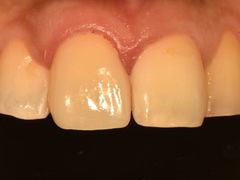 -精德口腔·种植修复·儿牙中心(财富中心店)