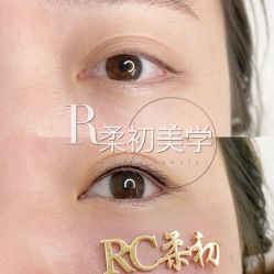-RC半永久纹眉纹发际线