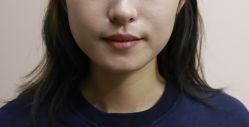 点击看大图 -广州美莱医疗美容医院