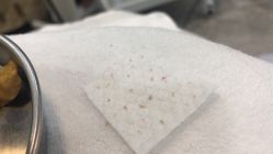 -清颜专业祛痘连锁店