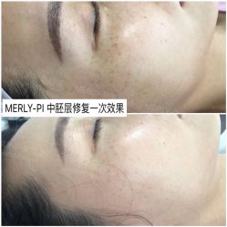 -MLP美丽派·问题肌疗愈中心