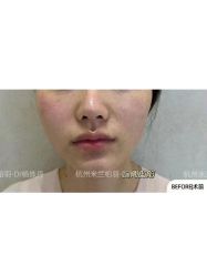 -杭州米兰柏羽医疗美容医院