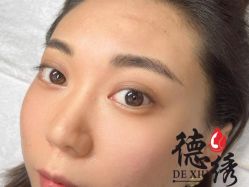 -德绣·机器野生眉发际线·美瞳线半永久