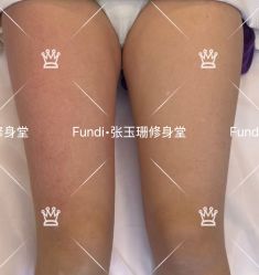 -Fundi张玉珊修身堂·indiba·BTL科技瘦身