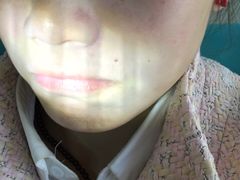 -华中科技大学同济医学院附属同济医院(汉口院区)