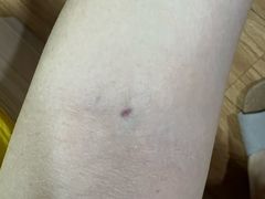 -首都医科大学附属北京同仁医院(西区)