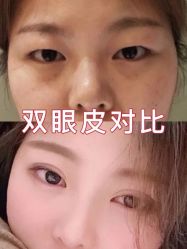 -长沙雅美医疗美容医院