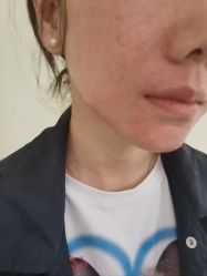 -海涛医疗美容·面部抗衰·注射美鼻