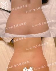 -Fundi张玉珊修身堂·indiba·BTL科技瘦身