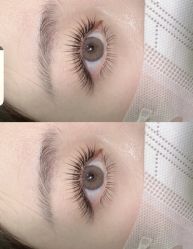 点击看大图 -光SPA科技美肤