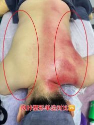 -良咔瘦身·减脂塑形