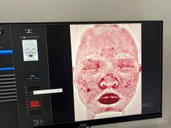 -Yestar杭州艺星医疗美容医院