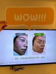 -塑青春&伊肤泉祛痘皮肤管理