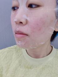 体验后-美瑞莎创美医疗美容