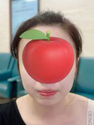 体验前-广州曙光医学美容医院