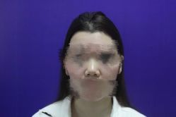 -成都西区医院整形美容