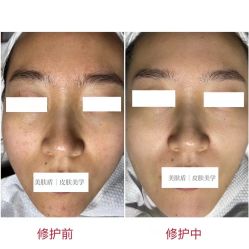 -美肤盾祛痘·问题肌头疗管理中心