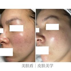 -美肤盾祛痘·问题肌头疗管理中心