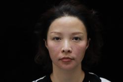 -上海漾颜医疗美容