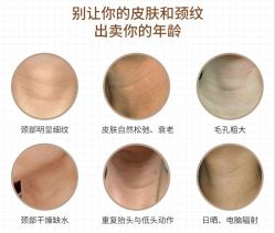 -应超小李飞刀整形