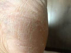 -华夏良子·足道SPA艾灸(铁道大厦店)