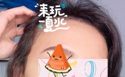 -大麦微针植发全国连锁