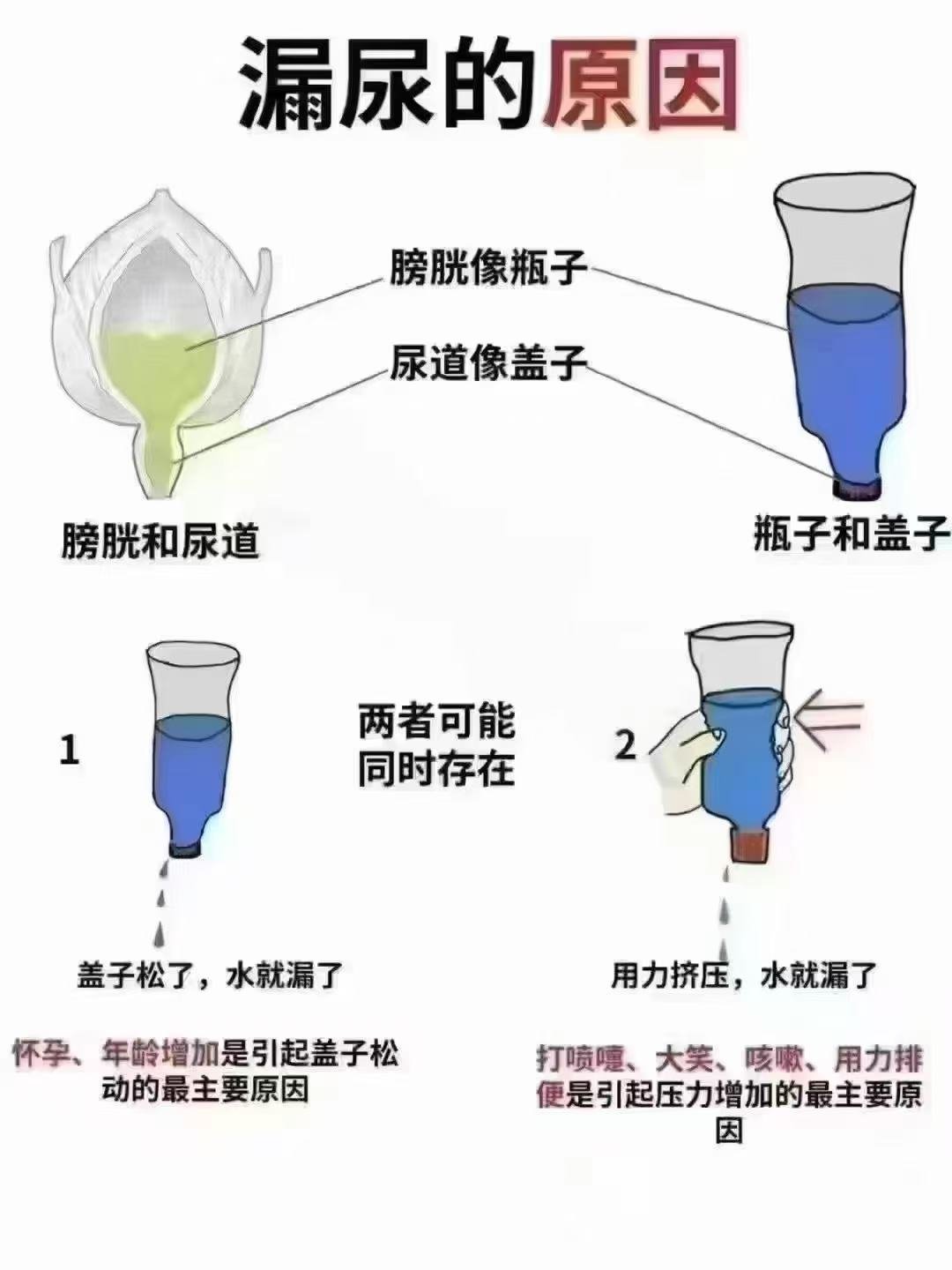 产后漏尿的原因 如图所示

