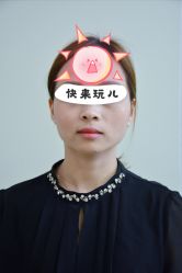 体验前-美莱医学美容医院