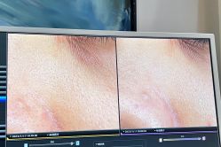 -苑苑vbeauty科技美容SPA