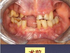 -团圆口腔·种植中心(锦江院区)