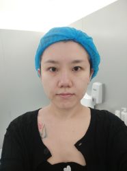 体验前-纯粹医美