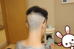 点击看大图 -大麦微针植发丨全国连锁