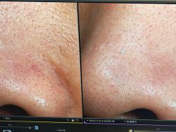 -苑苑vbeauty科技美容SPA