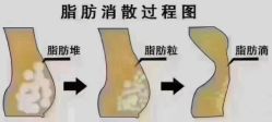 -瑞丝澜国际瘦身