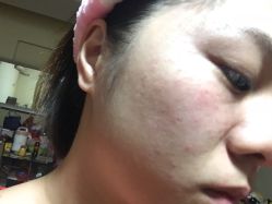 -弘美医美·艾维岚童颜抗衰中心