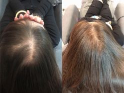 -LESSMORE科技头皮理容中心