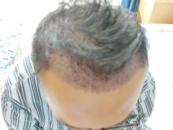 -雍禾植发全国连锁