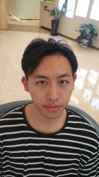 -大麦微针植发丨全国连锁