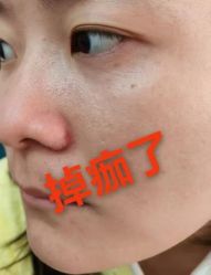 -北京美痣堂古方祛痣斑疣瘊
