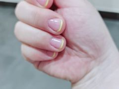 -艾通康缘艾灸.疼痛.睡眠养生馆(凤凰城店)