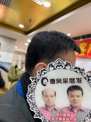 -唐风采假发补发定制