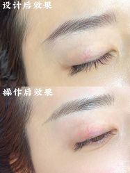 -德绣·机器野生眉发际线·美瞳线半永久