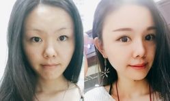 点击看大图 -SKINIST丽铂医疗美容
