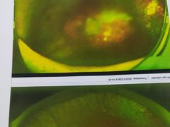 -武汉大学附属爱尔眼科医院(湖北总院)