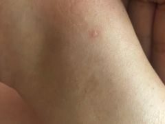 -大韩庄韩氏祖传正骨