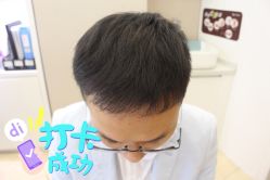 -大麦微针植发全国连锁