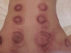 -大圣珍艾专业艾灸(万江0769店)