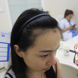 -大麦微针植发丨全国连锁